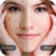 أيقونة البرنامج: Face Blemish Remover - Sm…