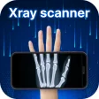 Xray Body Scanner Prank