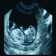 プログラムのアイコン：Ultrasound Flashcards Boa…