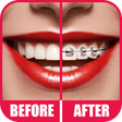 Icon of program: Braces 2.0