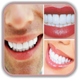 Programikonen: Teeth Whitening Tips: How…
