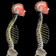 Иконка программы: Kyphosis  Rounded Back by…