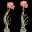 Kyphosis  Rounded Back by Muscle and Motion