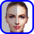 程序图标：Face Blemish Eraser makeu…