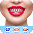 Programikonen: Braces Photo Editor 2021