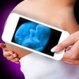 Programikonen: X-Ray Pregnant Woman Pran…