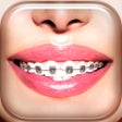 Programikonen: Braces Photo Booth