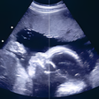 プログラムのアイコン：Pregnancy Baby  Baby Kick
