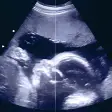 Pregnancy Baby  Baby Kick