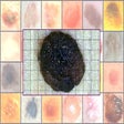 Icoon van programma: Skin Cancer Image Search