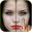 プログラムのアイコン：Pimples removing photo ed…