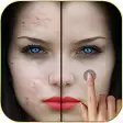 Pimples removing photo editing app
