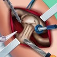 프로그램 아이콘: Ella Hip Surgery