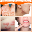 Icon of program: All Skin Diseases and Tre…