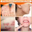 Programikonen: All Skin Diseases and Tre…