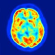 Programikonen: Neurosurgery: Whats the d…