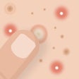 プログラムのアイコン：Blemish Acne Pimple remov…