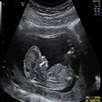أيقونة البرنامج: Choice Language Pro-Life