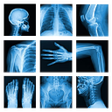 程序图标：Medical X-Ray Interpretat…