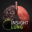 Icon of program: INSIGHT LUNG