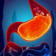 Programikonen: Gas Trouble in Stomach Ac…