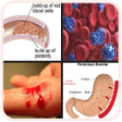 プログラムのアイコン：All Blood Disease  Treatm…