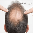 プログラムのアイコン：اسباب تساقط الشعر عند الش…