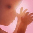 Programın simgesi: Pregnancy