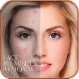 Face Blemishes Removal