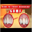 Icon of program: How To Cure Gingivitis At…