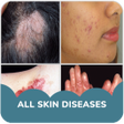 Skin diseases and treatment of