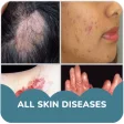 Skin diseases and treatment of