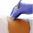 ไอคอนของโปรแกรม: Ultrasound cases