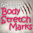 Get Rid of Body Stretch Marks Naturally