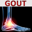 أيقونة البرنامج: Arthritis Gout Uric Acid …
