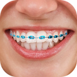 Icon of program: Braces : Add Braces On Ph…
