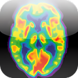 プログラムのアイコン：Radiology Core: Nuclear M…