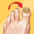 Solve your nail problem
