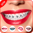 Icon of program: Braces 2019 - Braces Your…