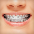 Ikona programu: Braces