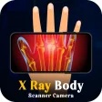 X Ray Mobile v.2.0