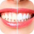 Иконка программы: teeth whitening