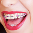 プログラムのアイコン：Braces Camera