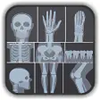 X-ray Interpretation for Medical Use