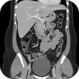 プログラムのアイコン：CT Abdomen Pelvis