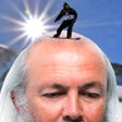 Ikon program: Bald Game