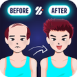 Icon of program: Yoga for Hair loss - Regr…