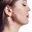 Ícone do programa: All Skin Diseases  Infect…