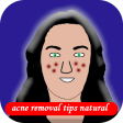 acne removal tips natural