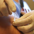 Icon of program: Dry Needling Clinic Companion